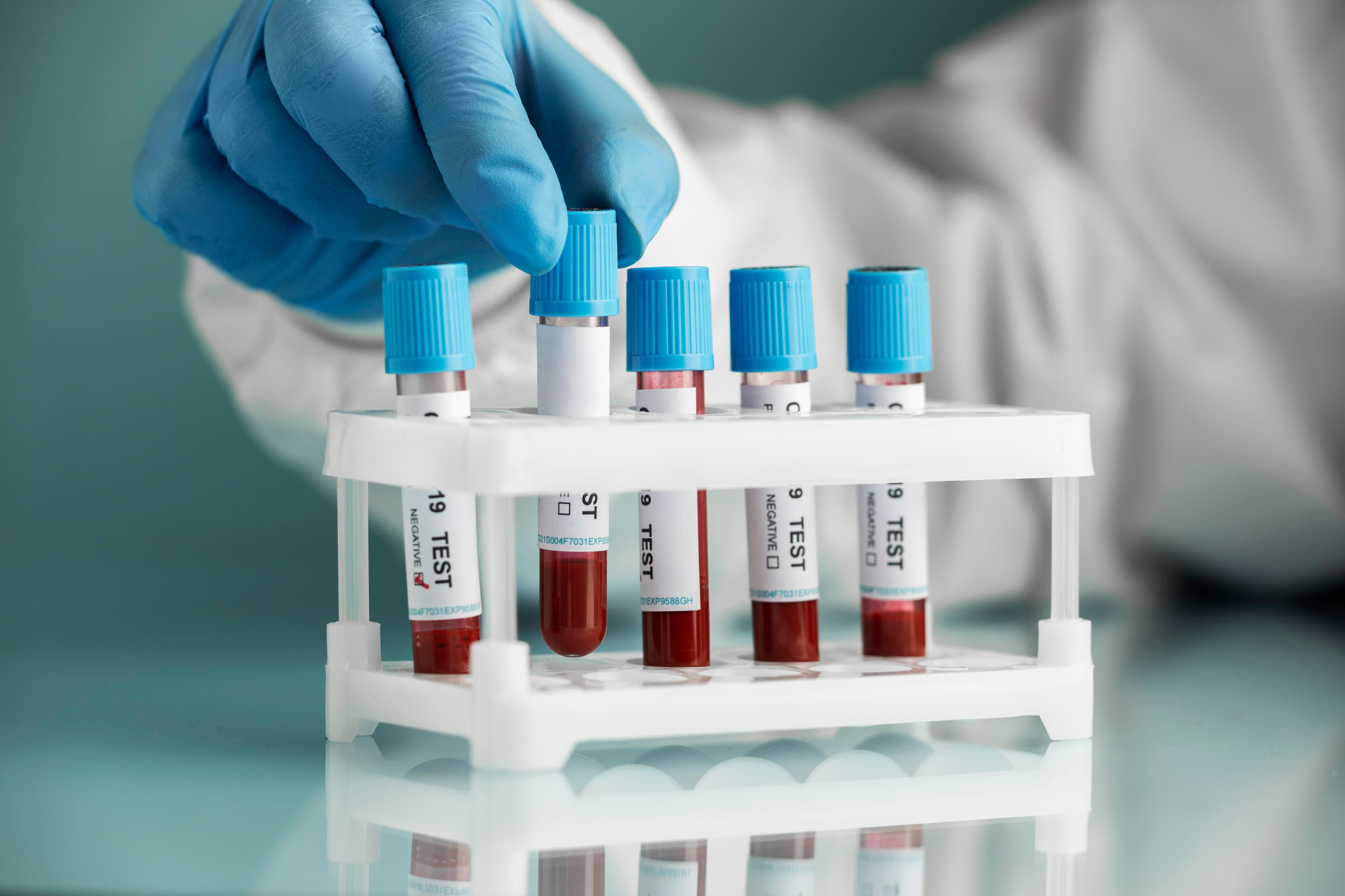 Hipercolesterolemia y alimentación: qué cambios sí tienen impacto